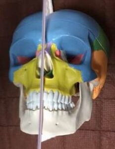 顔の歪みを　鼻から治す