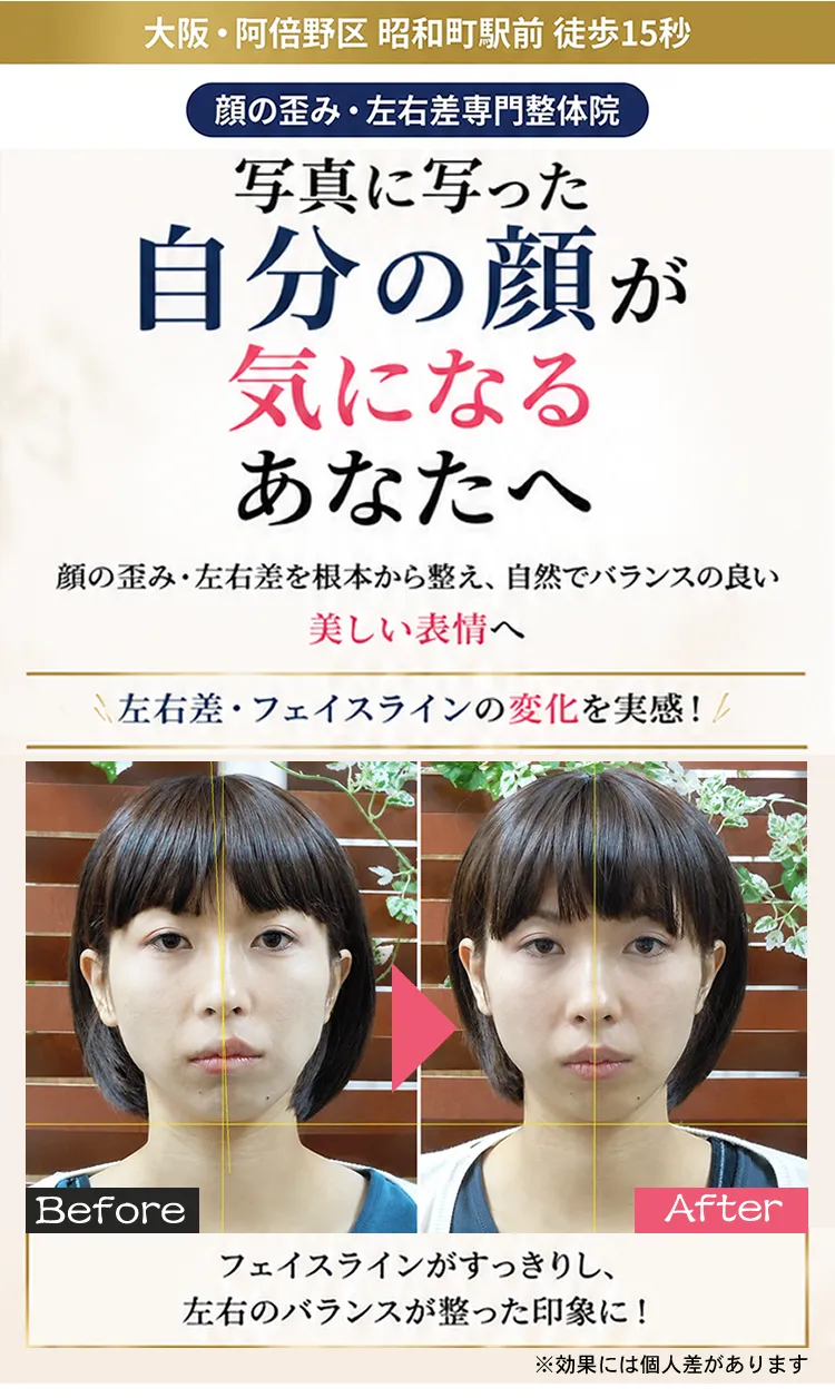 顔の歪み専門整体院1